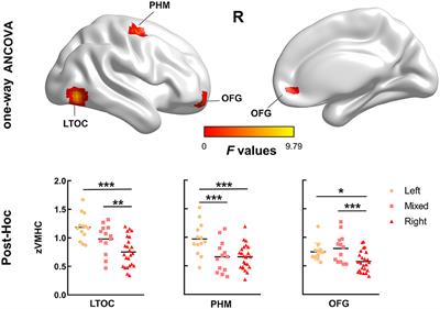 Voxel-Wise Analysis of Structural and Functional MRI for Lateralization of Handedness in College Students